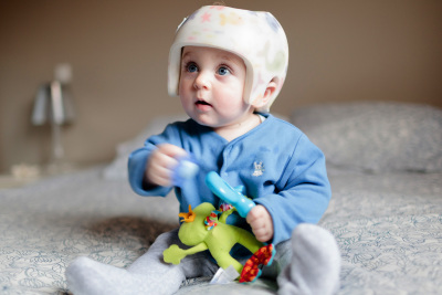 A baby wearing a plagiocephaly helmet sits on a bed.