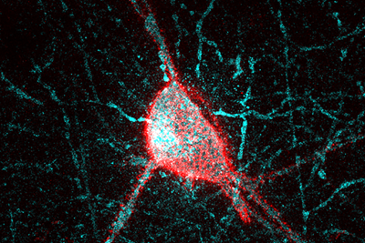 A parvalbumin interneuron surrounded by the perineuronal net.